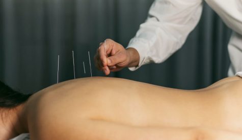 Close-up of a therapist performing dry needling by inserting a thin needle into a patient’s muscle to relieve pain and tension.