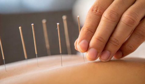 An Asian hand placing dry needles into the skin.